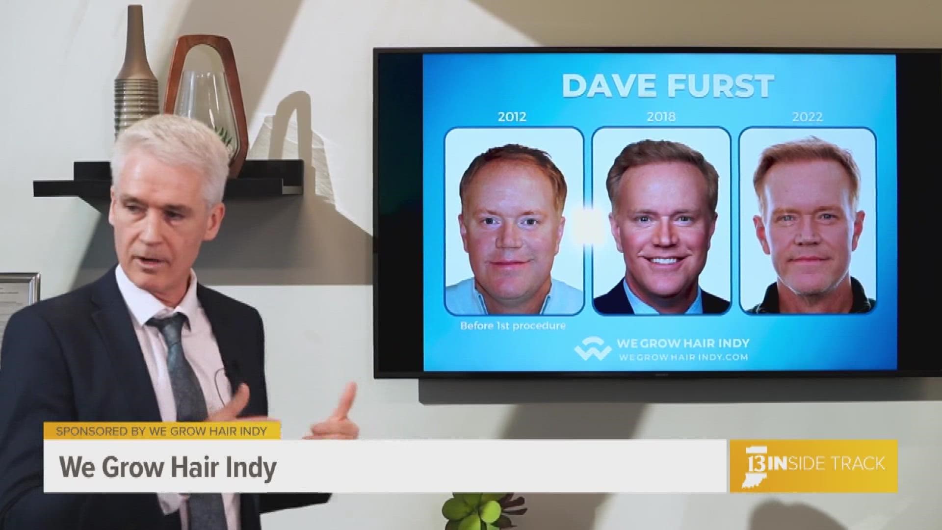 As the midwest's largest hair restoration clinic, We Grow Hair Indy treats clients such as former news anchor Dave Furst.