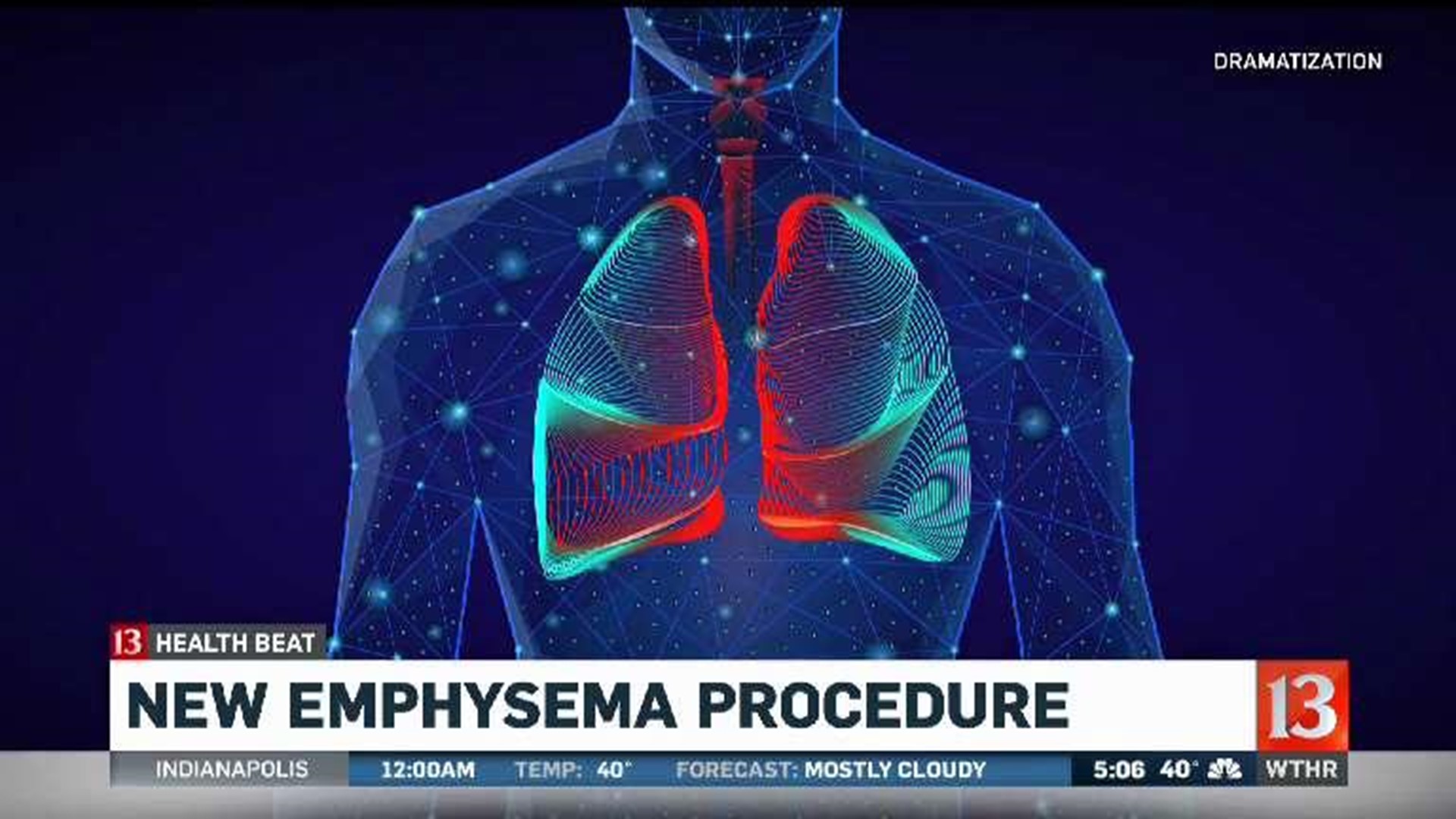 New Emphysema procedure