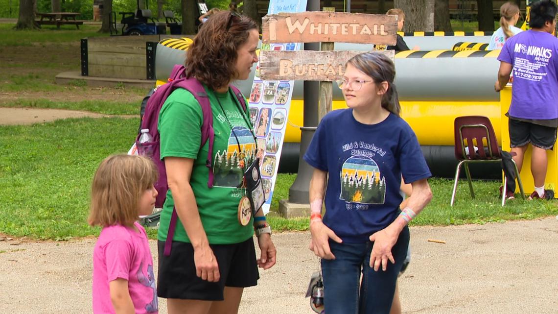 'It's so including and it's so amazing' | Girl burned by trying social media trend finds healing, friendship at Hoosier Burn Camp