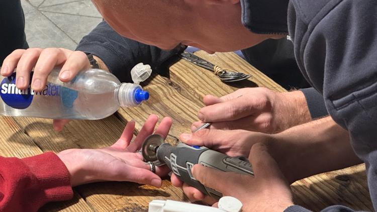 Firefighters’ Dremel tool saves the day in freeing boy’s fingers from stuck rings