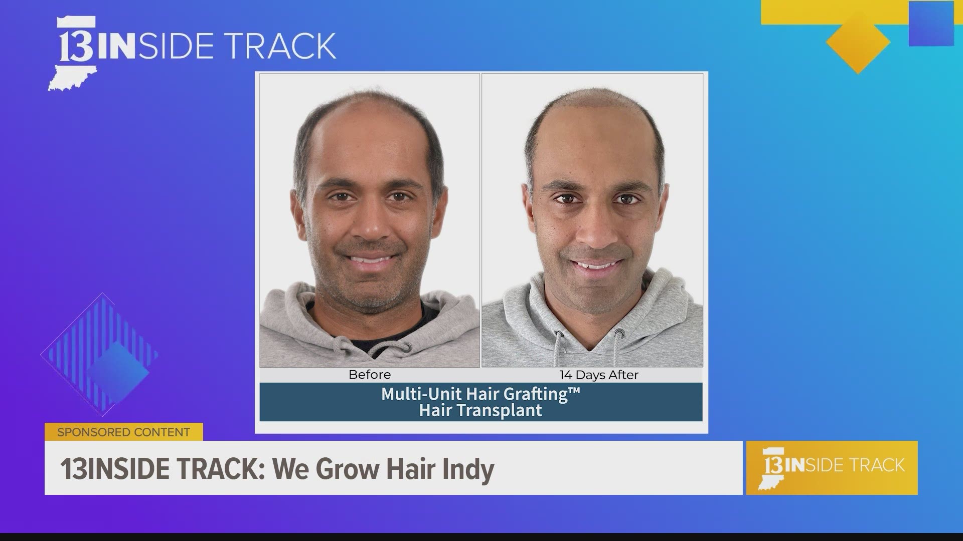 Clients to We Grow Hair Indy receive a customized plan because no hair loss case is the same.