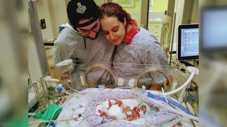 Riley Children's Hospital gives 'micro-preemie' a new chance at life