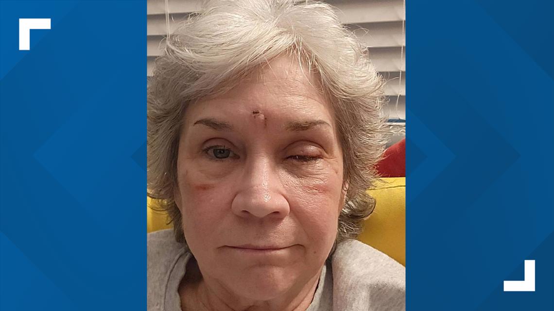 Sullivan Hardware road rage shooting victim tracks recovery