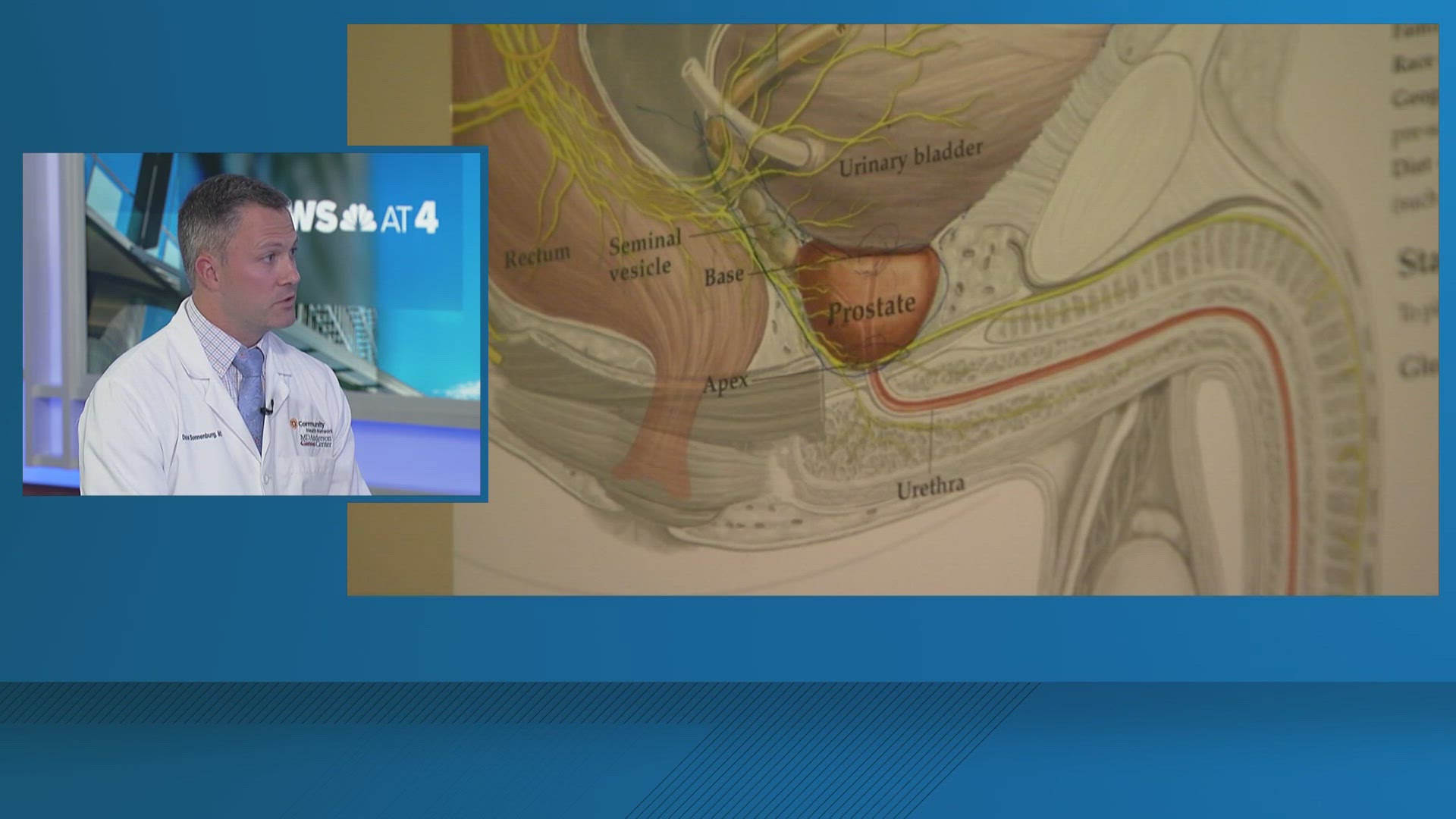 Dr. Dan Sonnenburg, a medical oncologist at Community MD Anderson Cancer Center, joins 13News at 4 to discuss prostate cancer awareness.