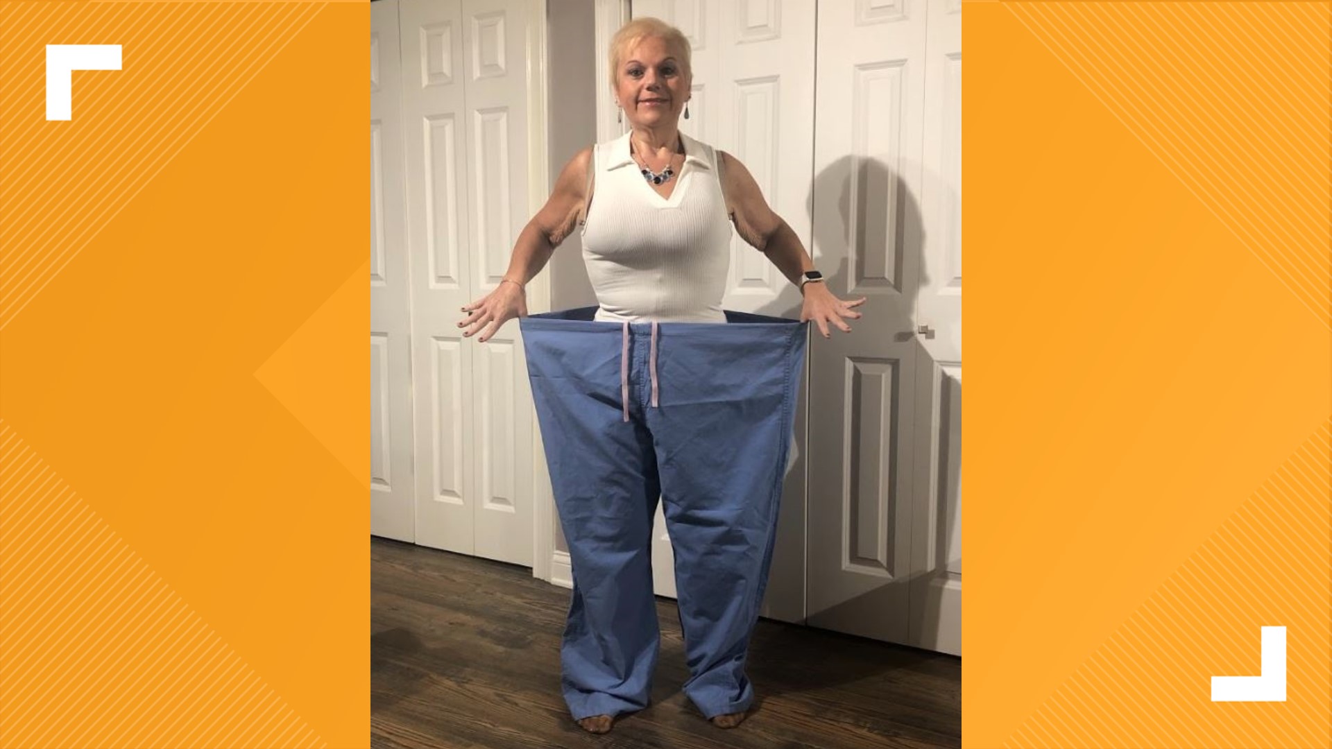 Jennifer Pruss lost half her body weight in the eight months after her surgery.