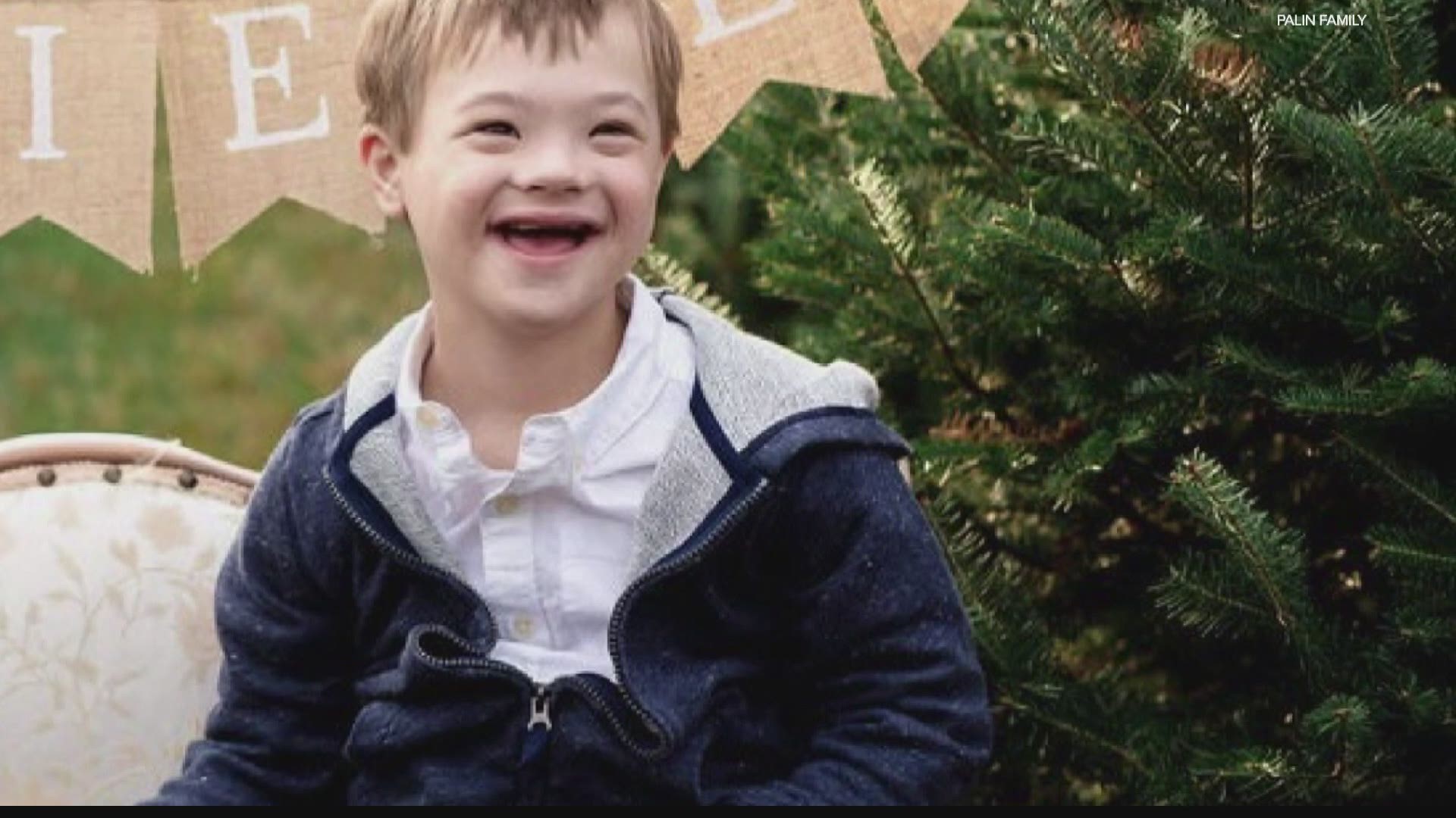 Advocates for Hoosiers with Down syndrome and their families are calling on the state to open up vaccine eligibility to care givers and family members.