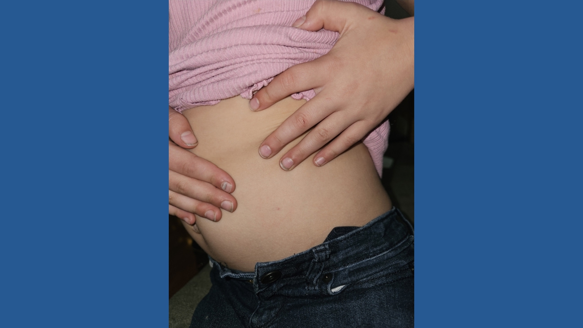 retatrutide symptoms Semaglutide Withdrawal Symptoms: What to Know About Retatrutide Access retatrutide symptoms Semaglutide Withdrawal Symptoms: What to Know About Retatrutide Access