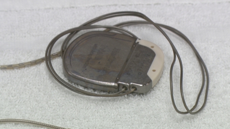 Hamilton County coroner joins ‘My Heart Your Heart’ pacemaker donation project