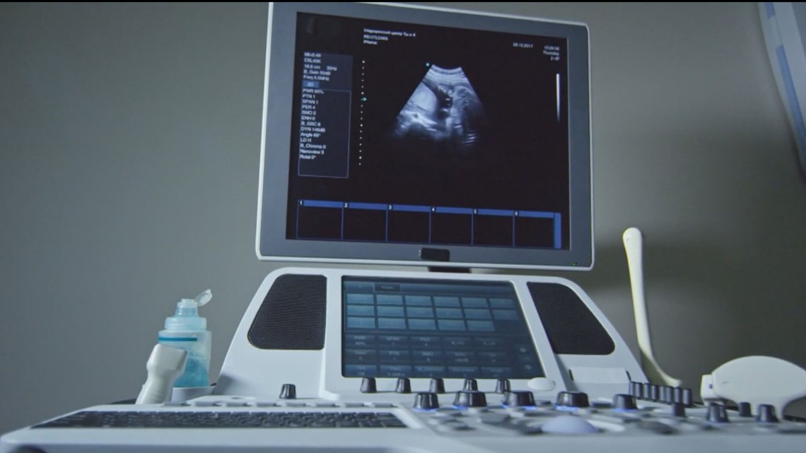 State Supreme Court to hear abortion case - Vimarsana News