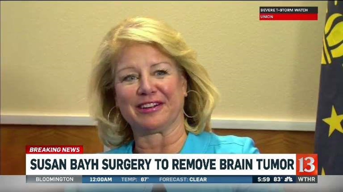 Susan Bayh has surgery