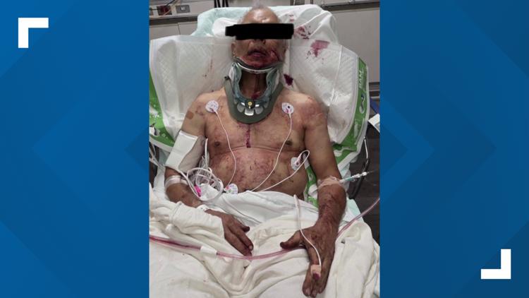 'Lucky to be alive' | Man suing ex-NFL QB Mark Sanchez, FOX Corporation after Indianapolis stabbing