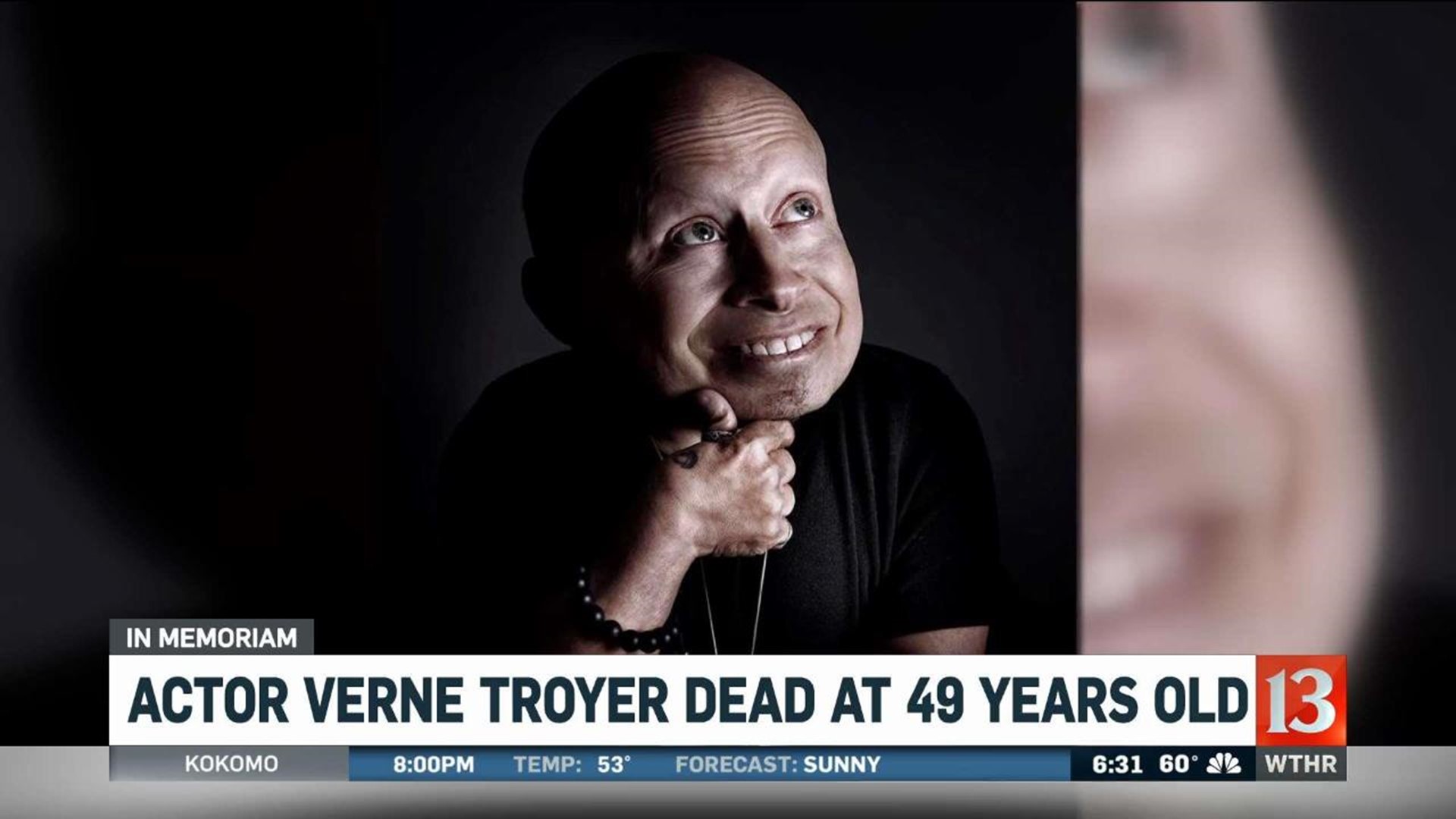 Verne Troyer Dies at 49 Years Old