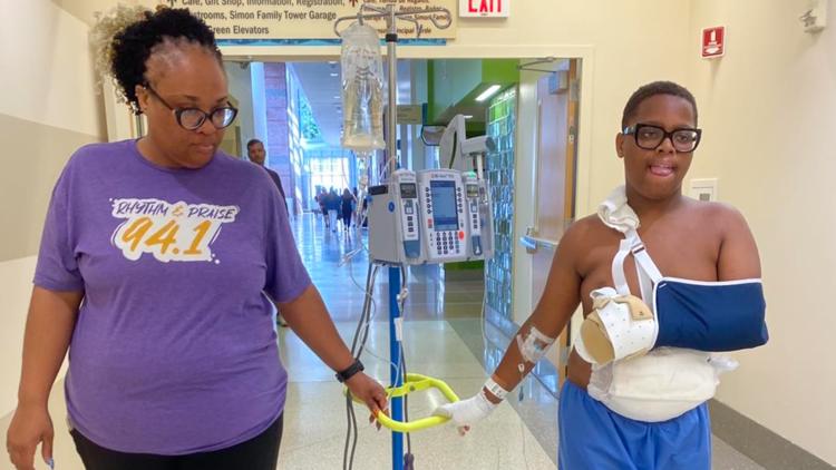 11-year-old Fort Wayne boy recovering from severe hand injury after playing with fireworks
