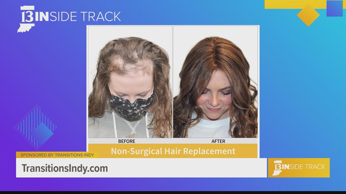 13INside Track debunks 5 myths about hair growth treatments with Transitions Indy