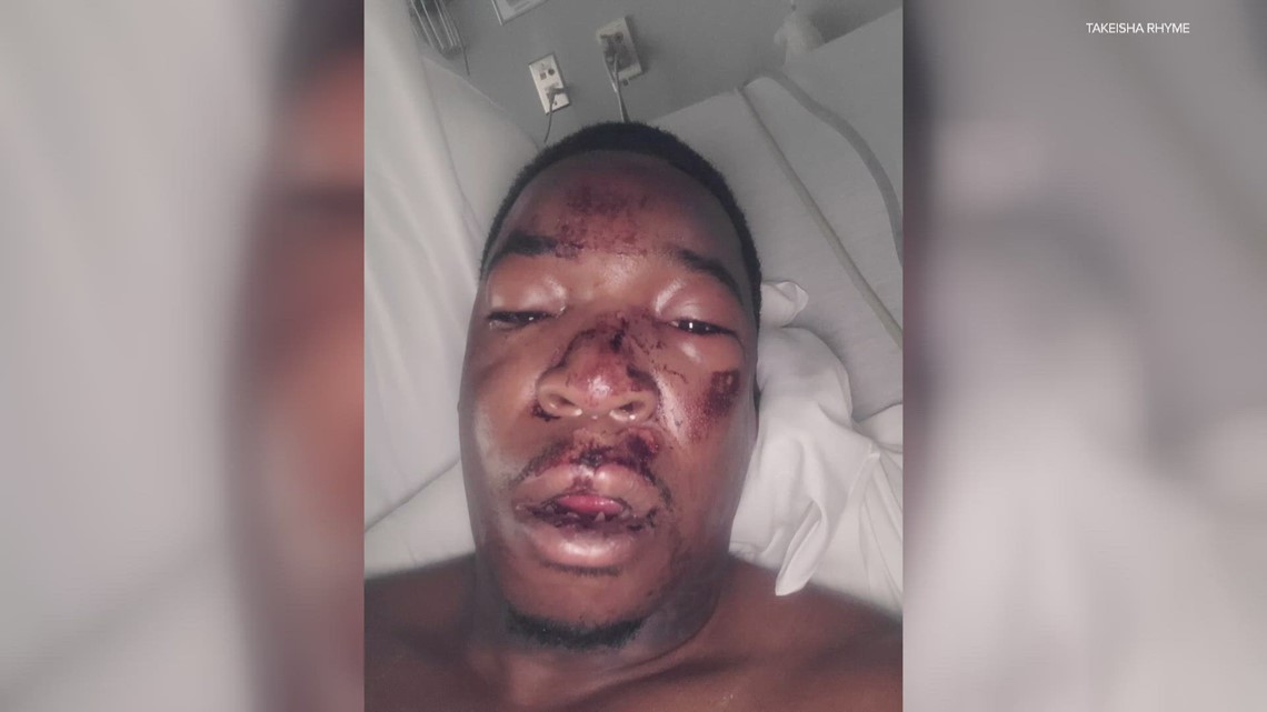 Tort notice claims excessive force by Greensburg Police - Vimarsana News