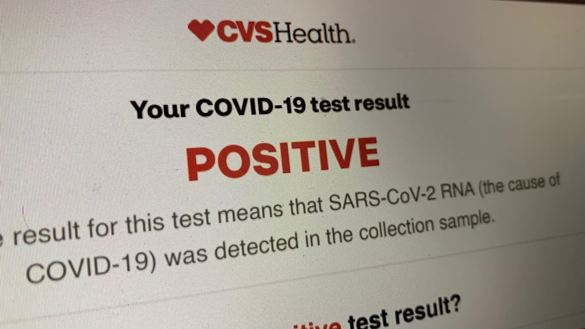cvs covid test result