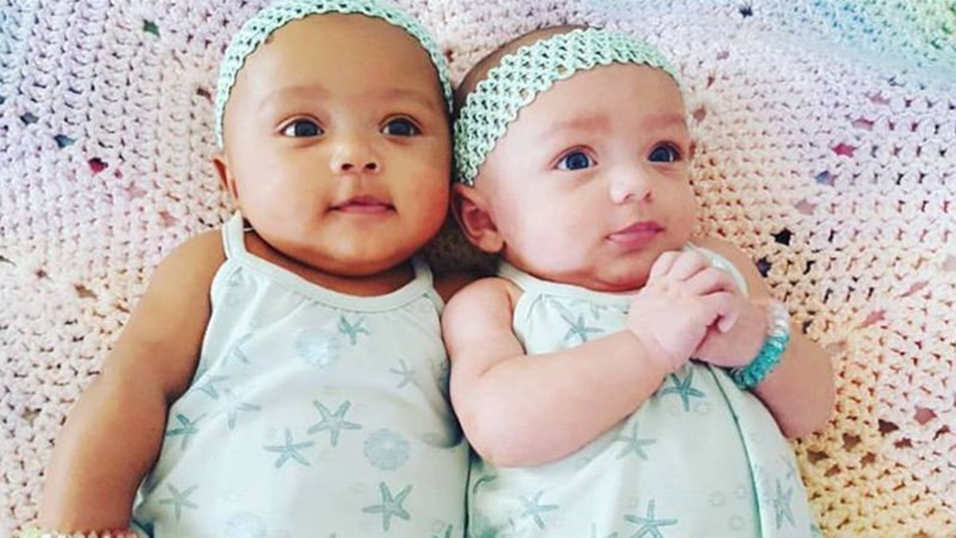 Twin baby girls from Illinois born with different skin colors