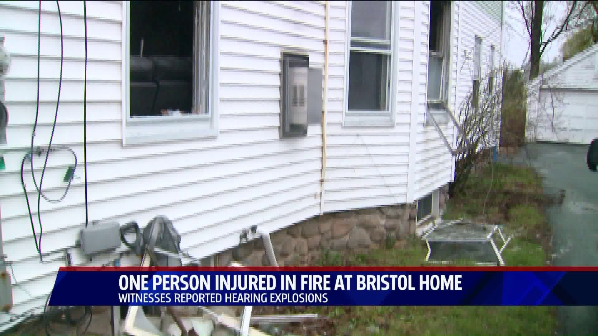 One person taken to the hospital after early morning Bristol fire