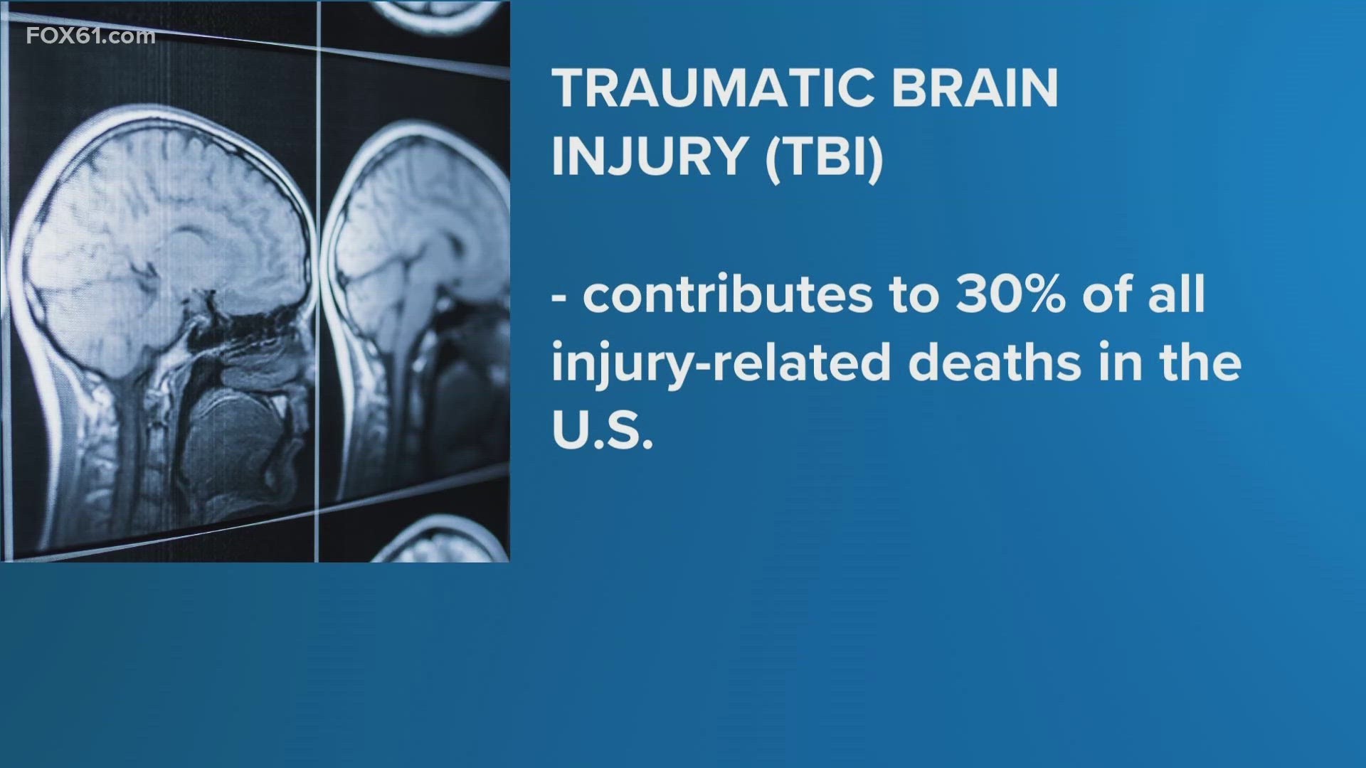 Brain injury awareness month in Connecticut