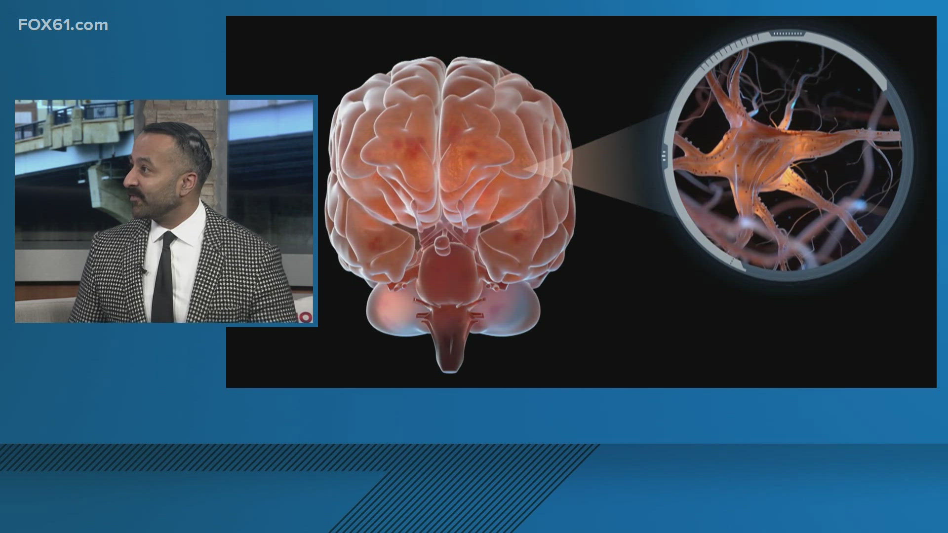 Dr. Syed Hussain from Trinity Health of New England explains what 'brain rot' really is, as well as discusses HPV testing preferred over pap smears.