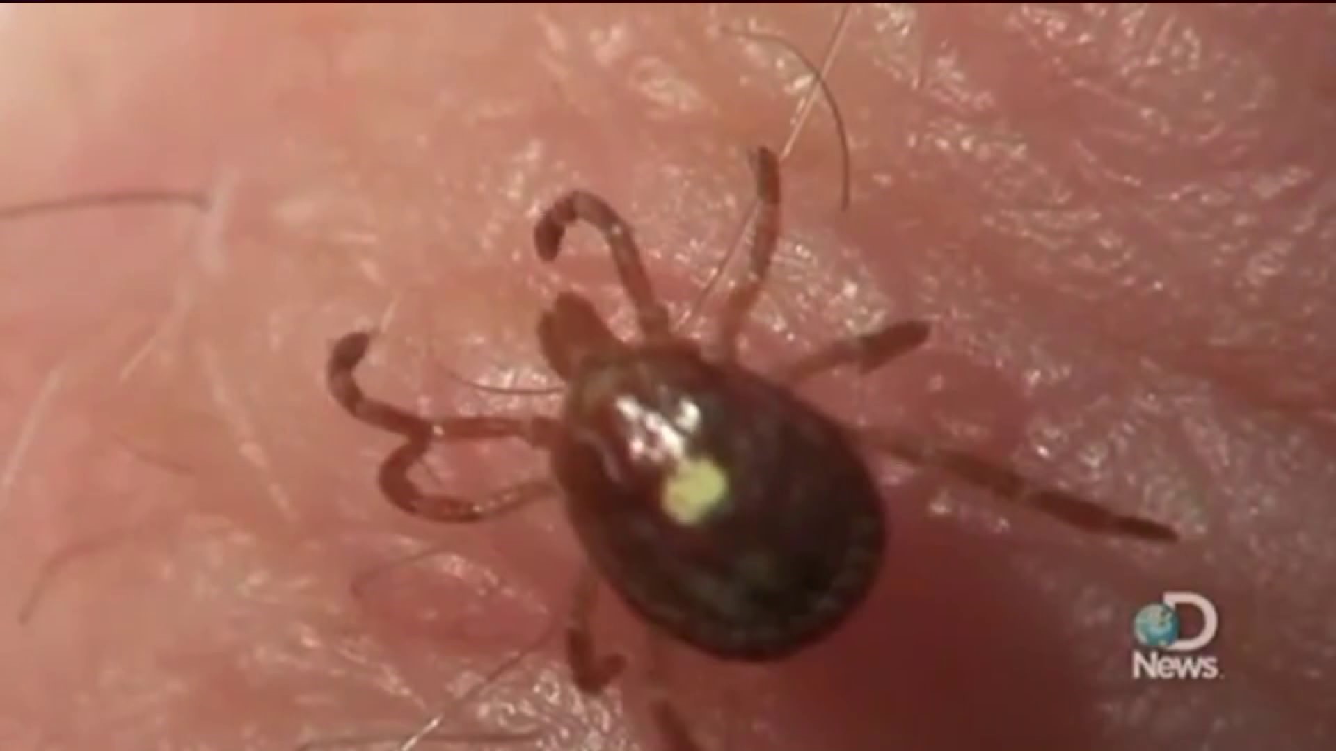 With increase in ticks comes possibility of more dangerous diseases
