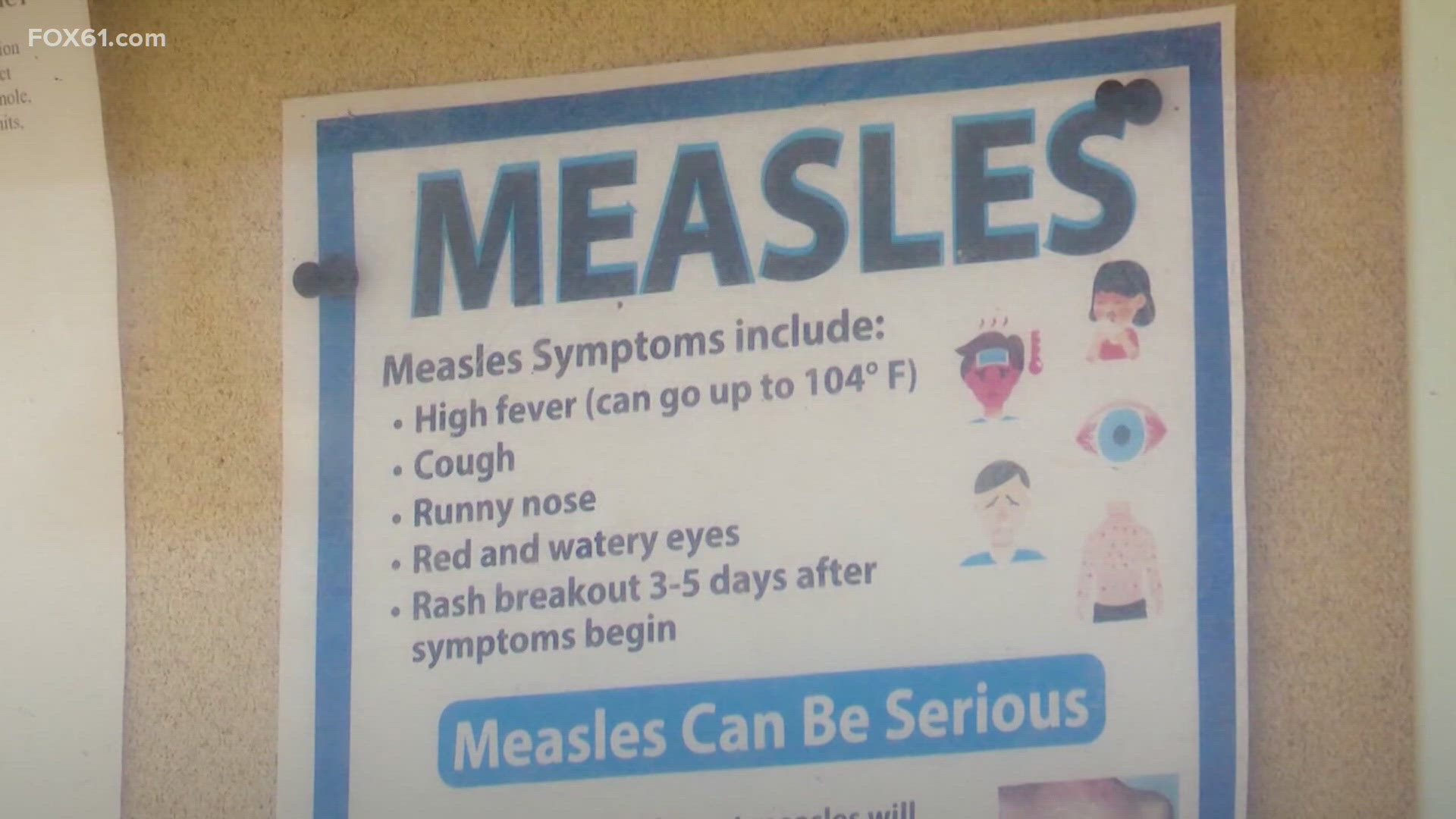 Connecticut DPH confirms third case of measles in 2026