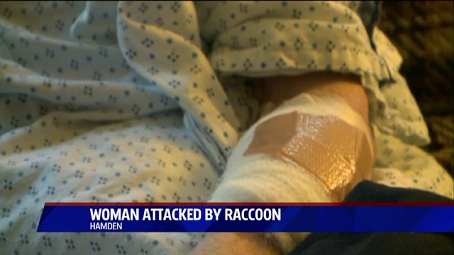 Woman Attacked By Raccoon