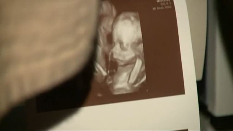 3d baby scan