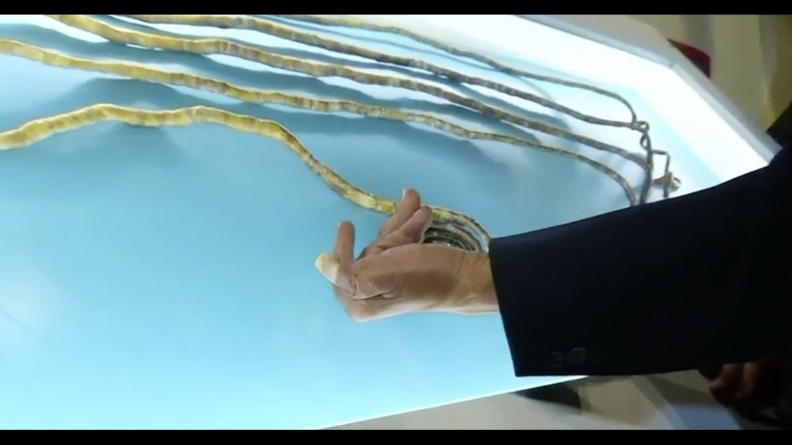 Grandma With World's Longest Nails Is Selling Them For £35,000