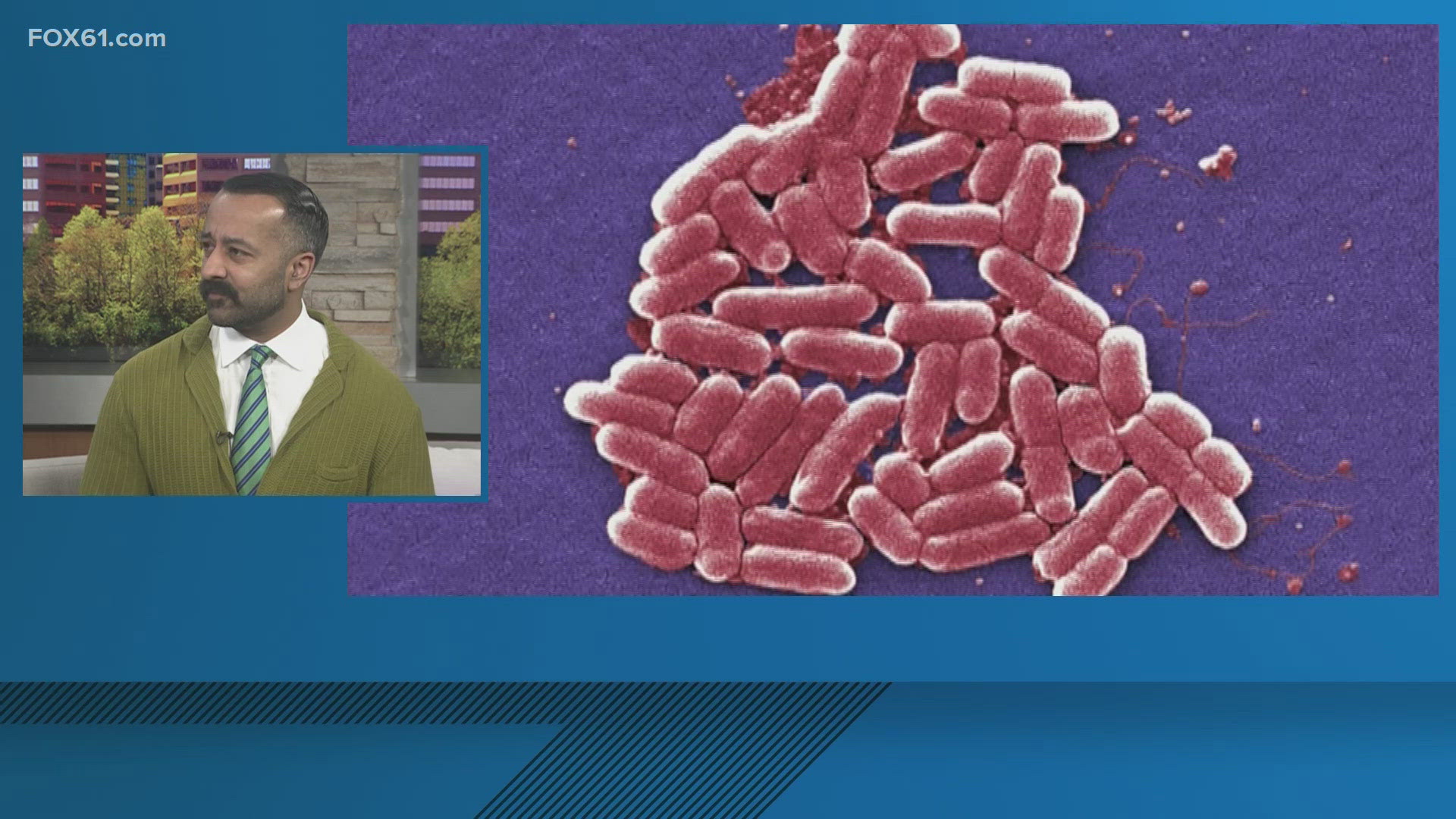 Dr. Syed Hussain from Trinity Health of New England discusses the latest health concern regarding McDonald's and an E. coli outbreak.