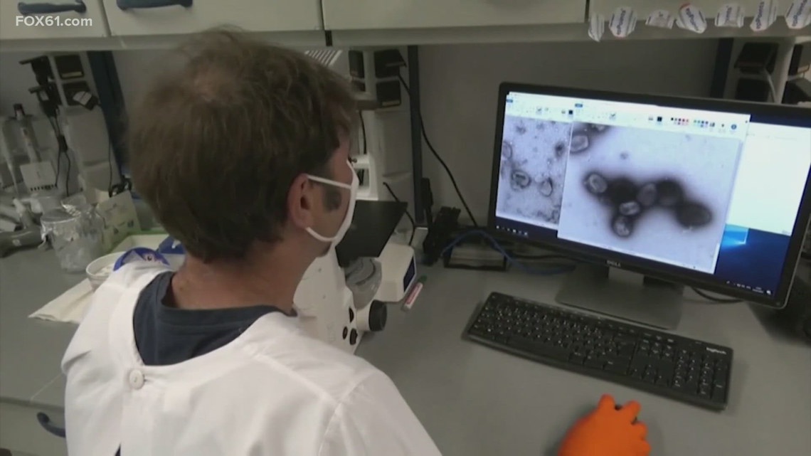 Connecticut Department of Public Health confirms first case of clade I mpox