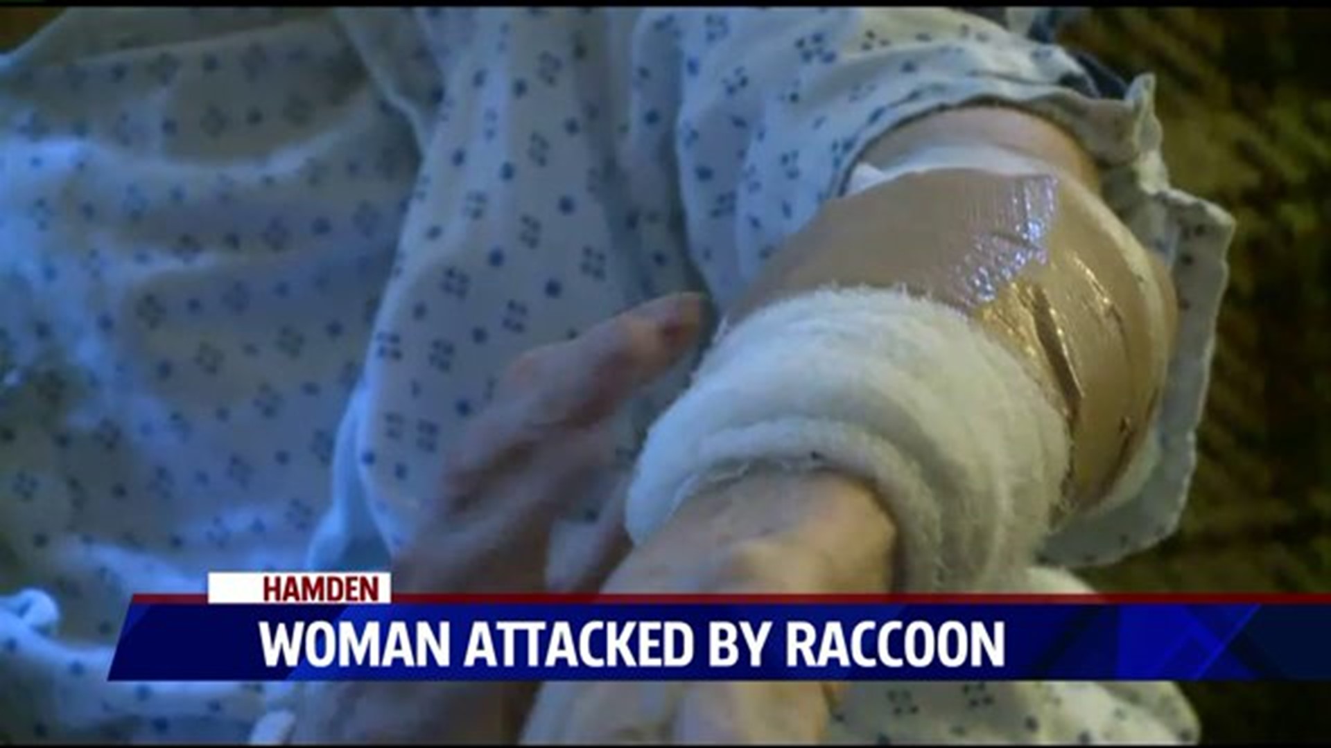 Woman Attacked By Raccoon