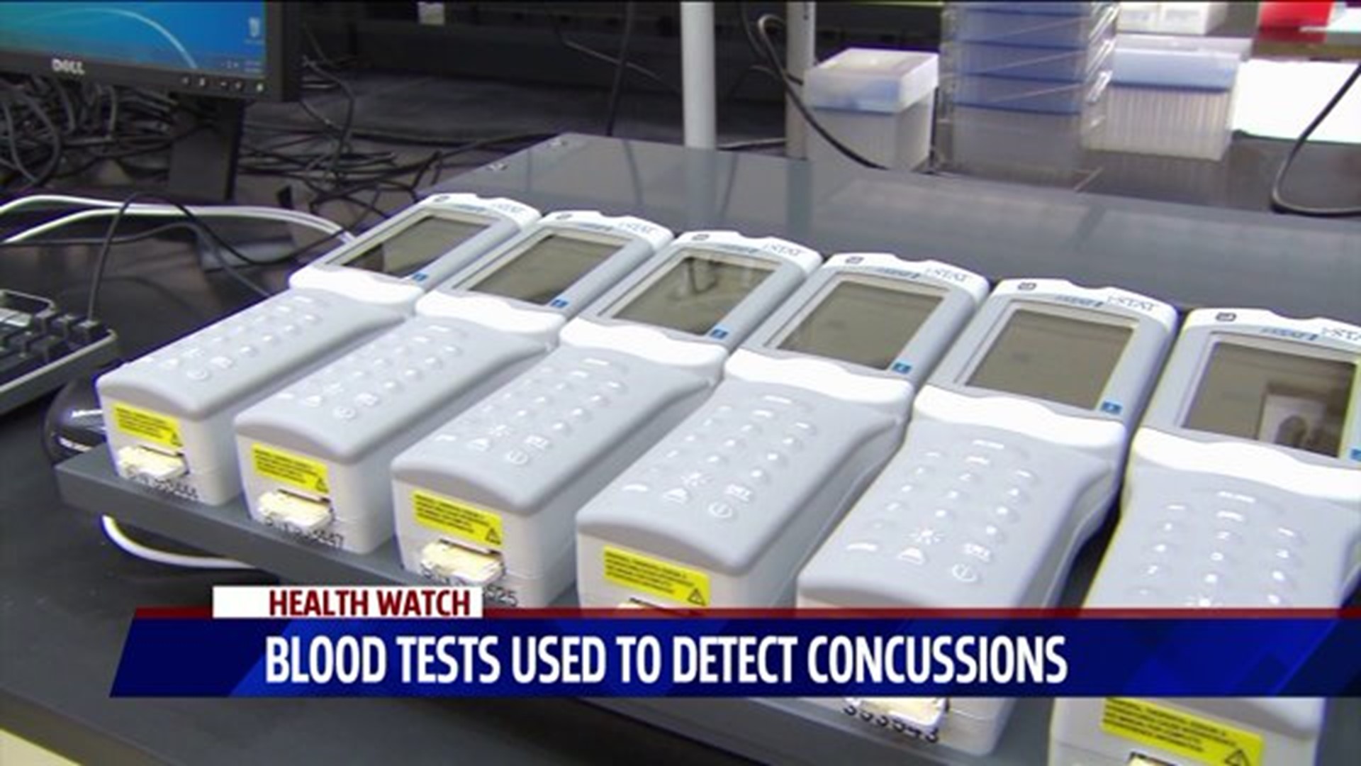 Health Watch: Concussions blood test