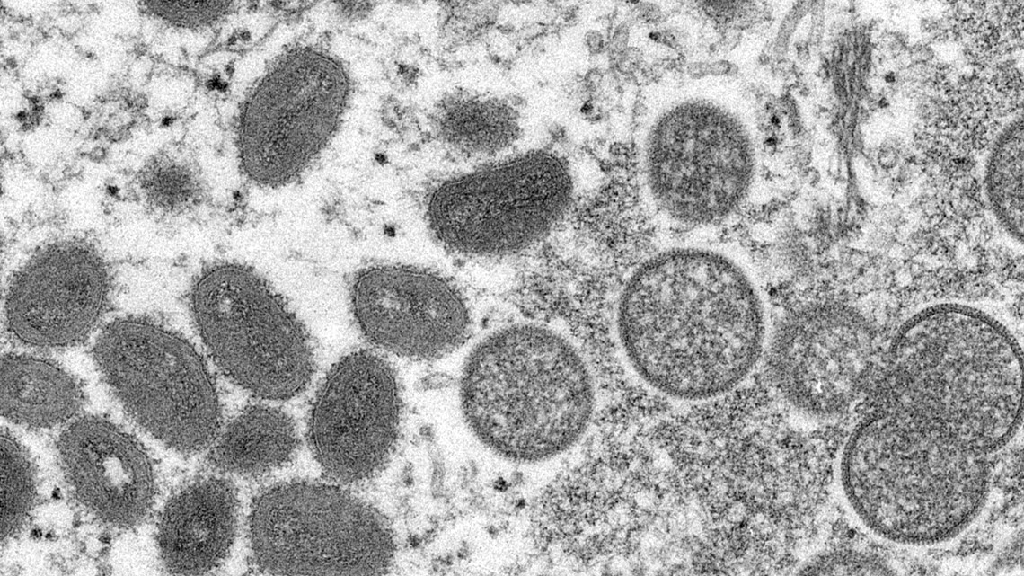 First monkey pox case confirmed in Arkansas