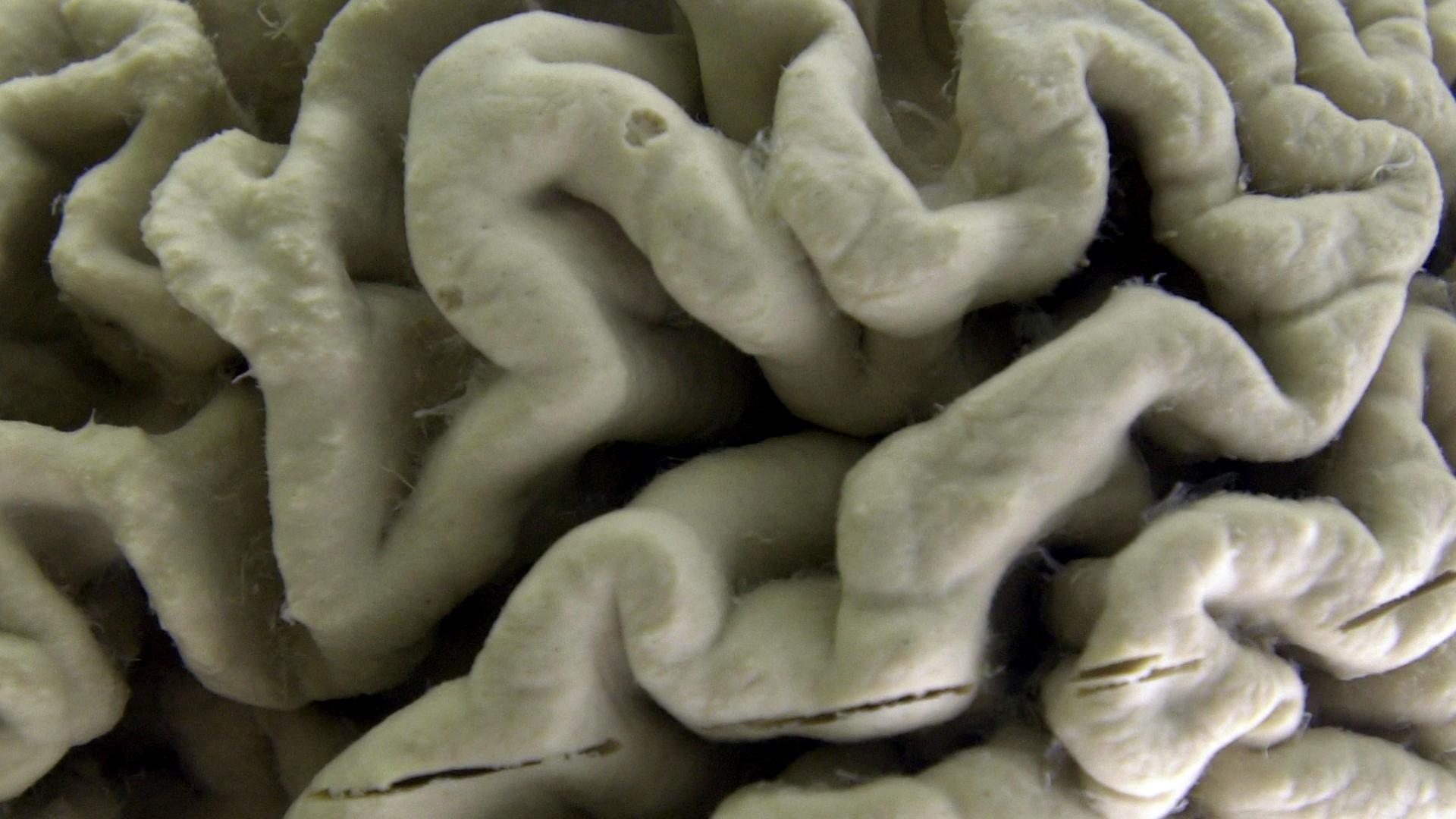 connecticut-releases-new-dementia-care-guide-for-alzheimer-s-awareness