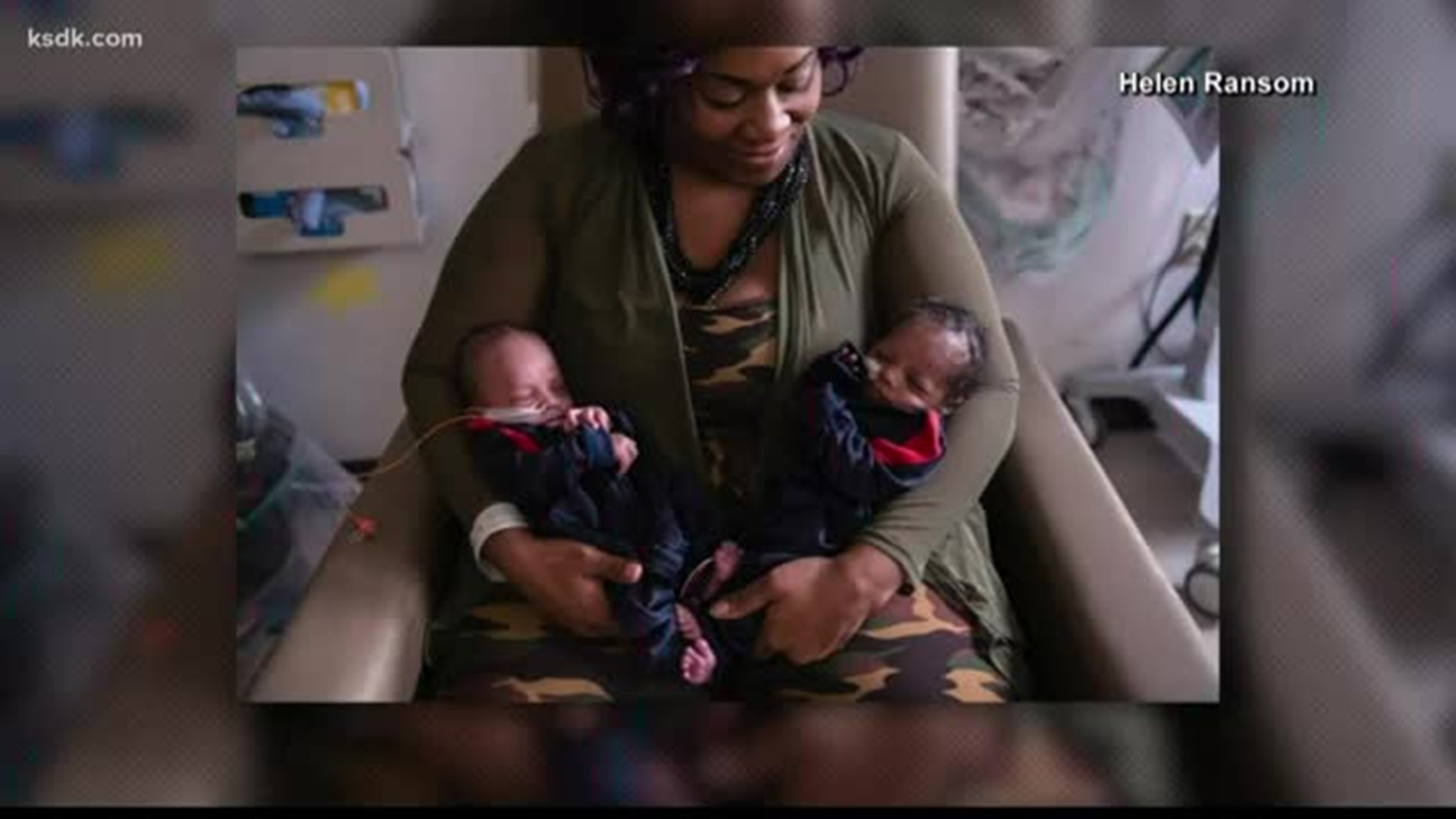 Kansas City, Missouri hospital caring for 12 sets of twins