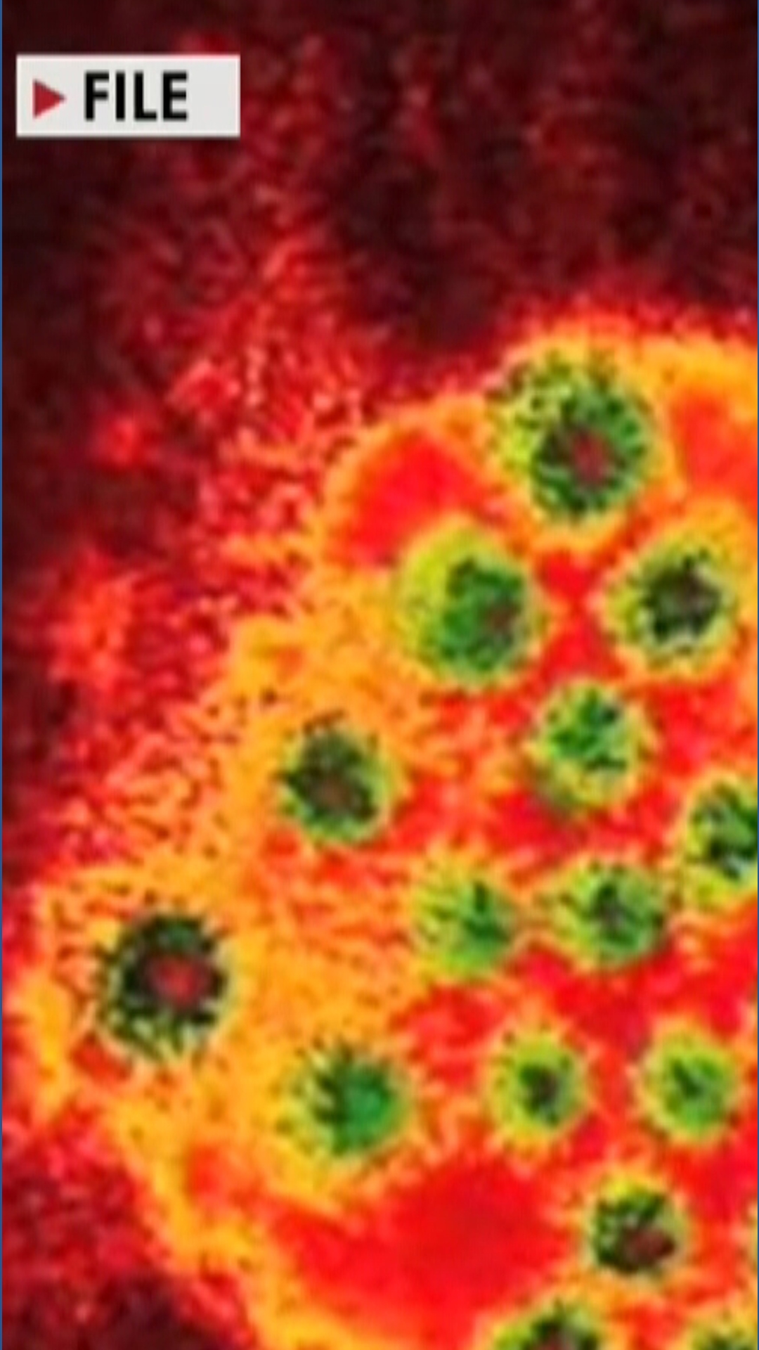 Norovirus outbreak closes Connecticut elementary school, highlights ...