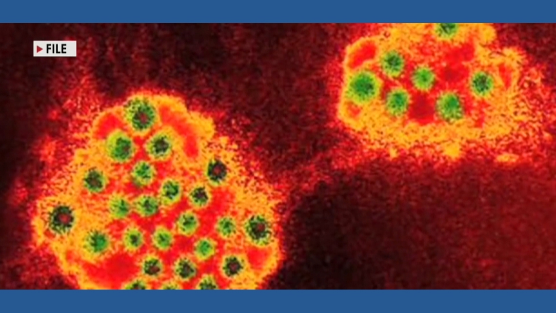 Norovirus outbreak closes Connecticut elementary school, highlights ...