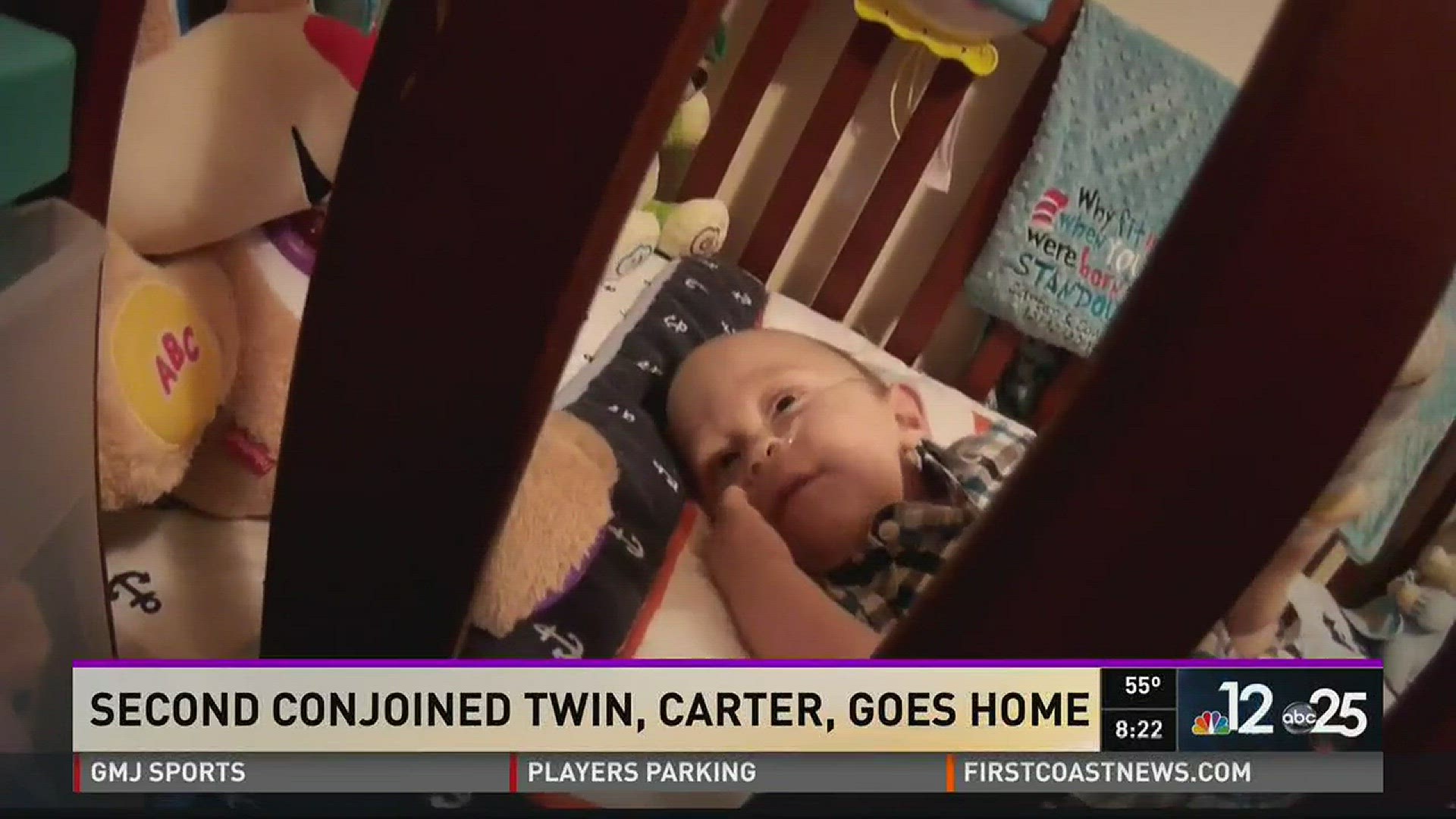 Second conjoined twin, Carter, goes home