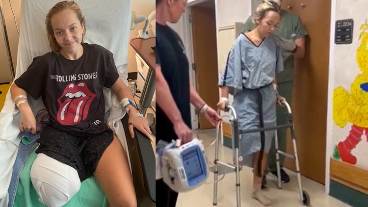 'She was ready': Florida teen walks after leg amputated from shark attack