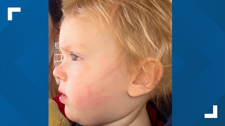 Virginia Beach Parents speak out after accusing daycare teacher for slapping their one-year-old