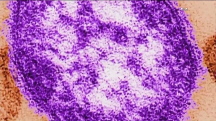 Georgia confirms sixth measles case of 2025