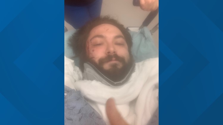 First responder intentionally crashes car after accelerator gets stuck, survives