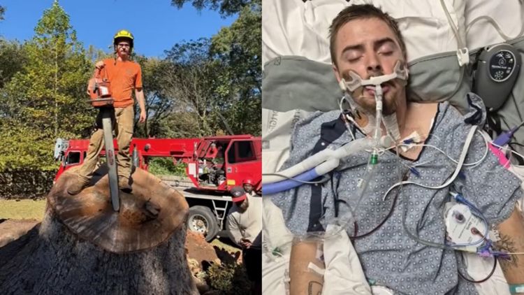 Gwinnett County man hit, paralyzed by falling tree limb during work