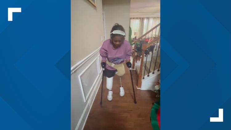 She lost her arms and legs now she is walking again