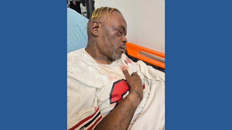 Caught on Camera: Man beaten outside tailgate; police searching for suspects