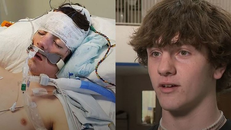15-year-old basketball player beats incredible odds to come back to the court