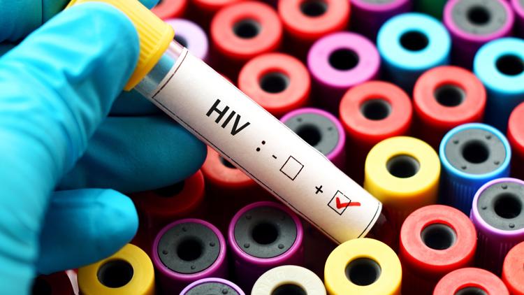 Fulton County secures millions in grant money to fight HIV