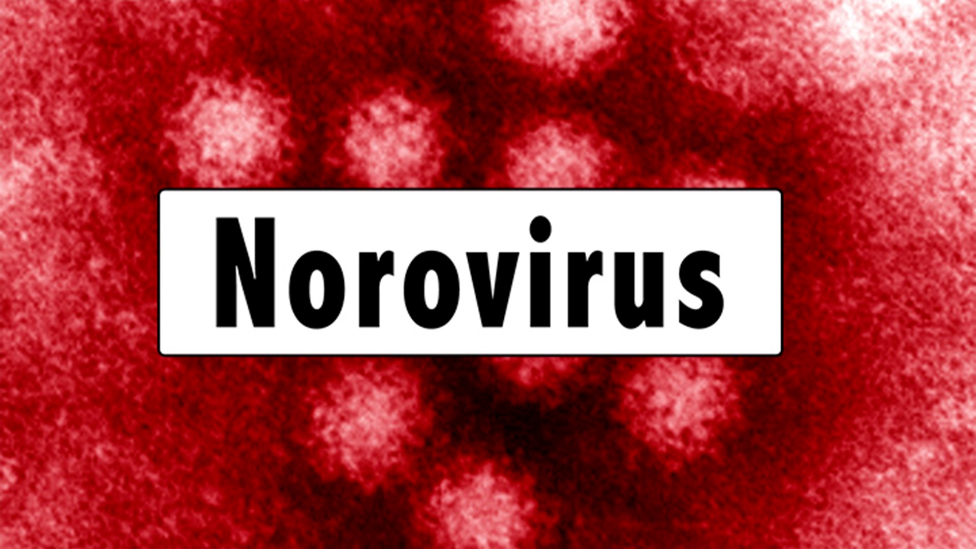 There's still no word yet on what's causing an outbreak of the norovirus on the UAH campus.