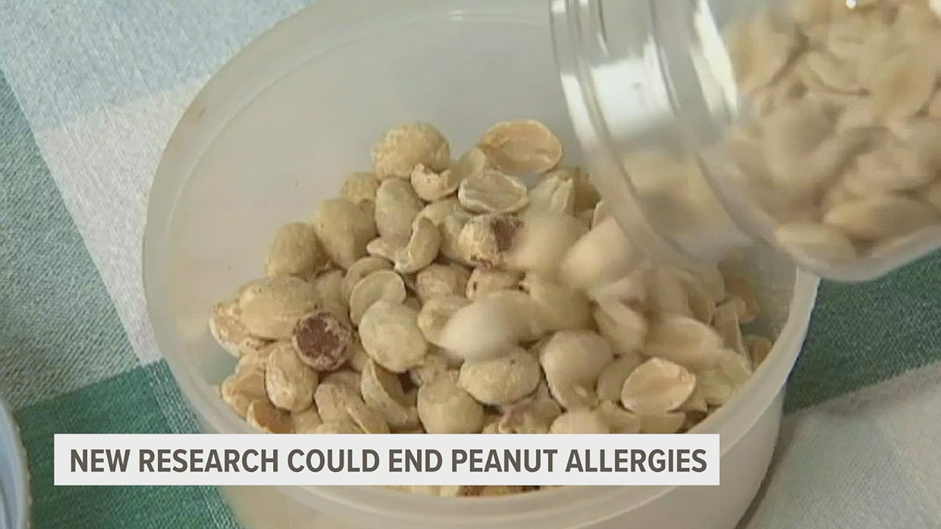 Scientists from Indiana University say their injection can prevent allergic reactions from peanuts, and are eyeing other allergies to target in the future.